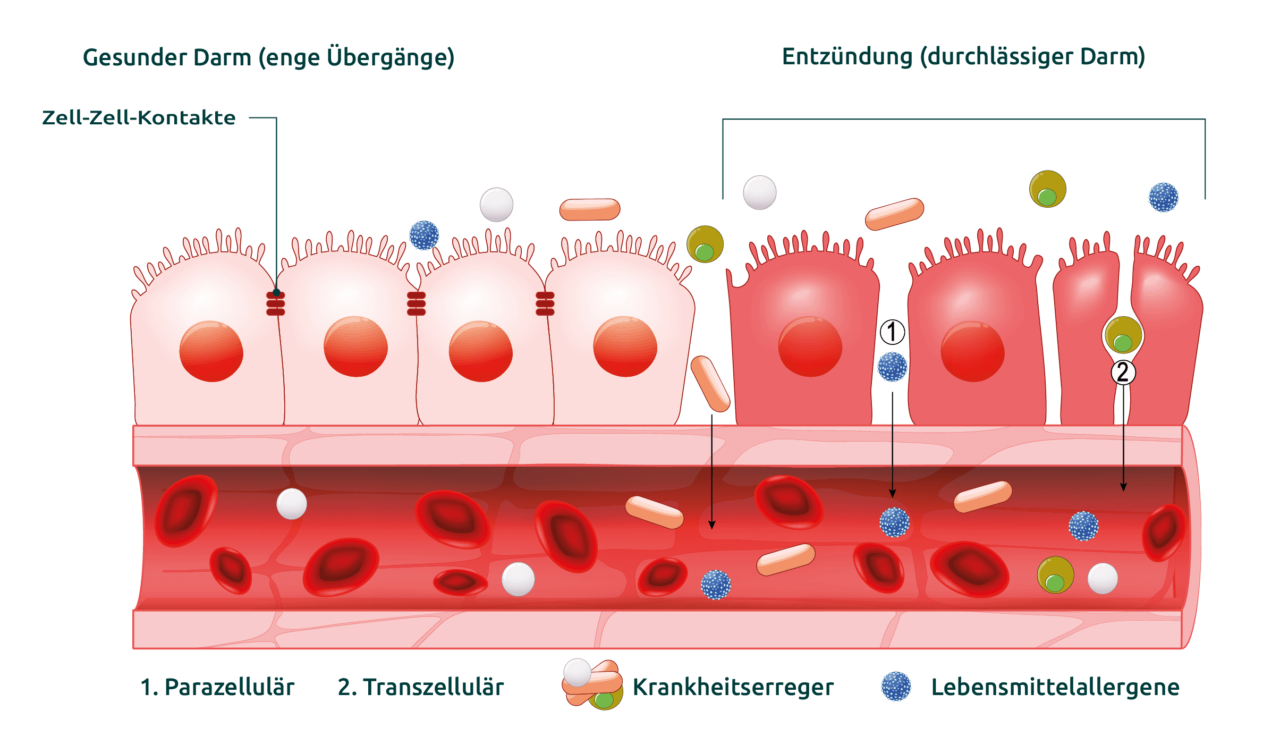 Themenwelt: Darmgesundheit | Kyberg Vital