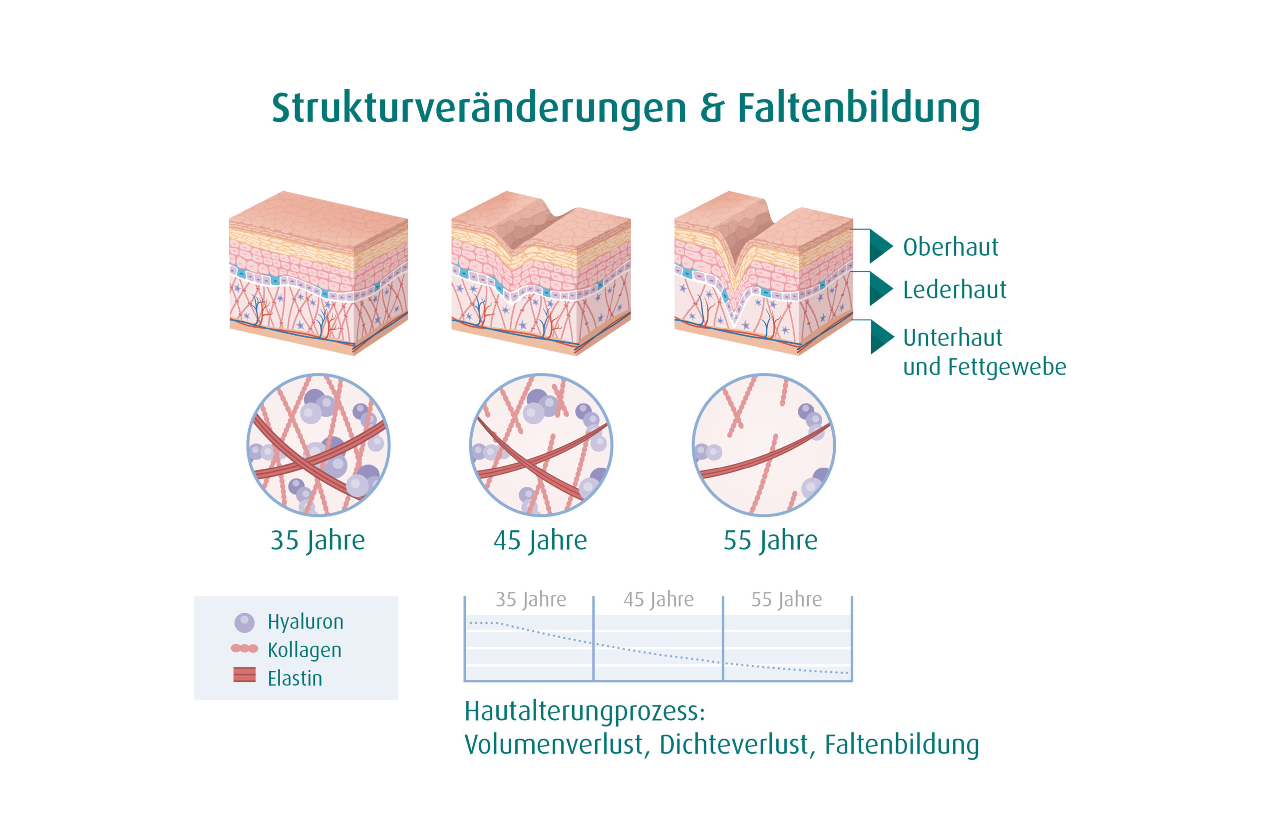 Struktur-Haut